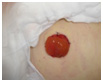 stoma-ostami01